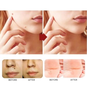 Essential Oil Spot Remover, Spot Remover and Corrector